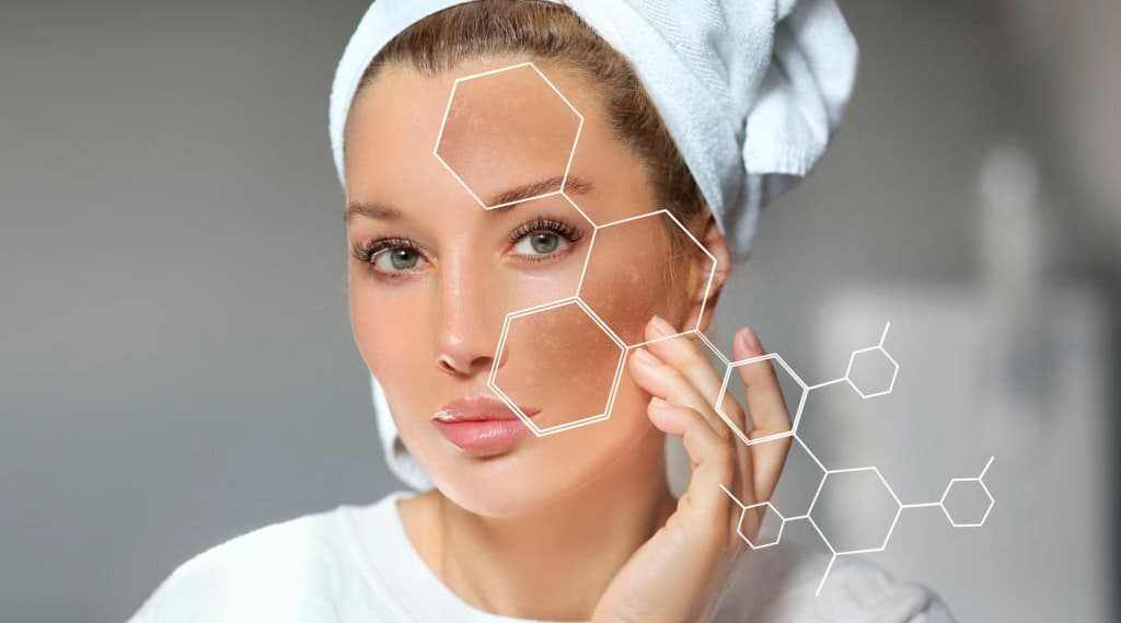 Facing Melasma: Identifying Causes and Exploring Treatment Options