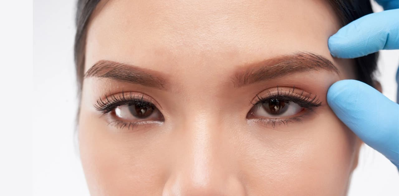 Brow Lift: Procedure, Surgery, & Recovery