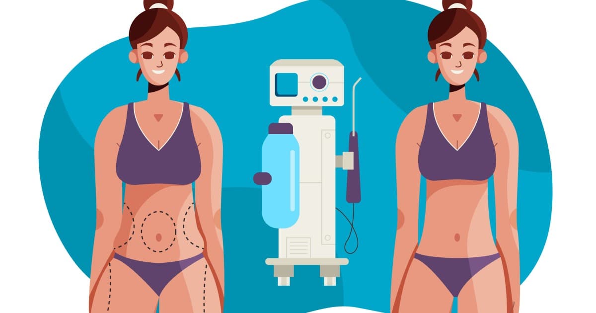 Tummy Tuck vs. Liposuction: Understanding the Differences and Benefits