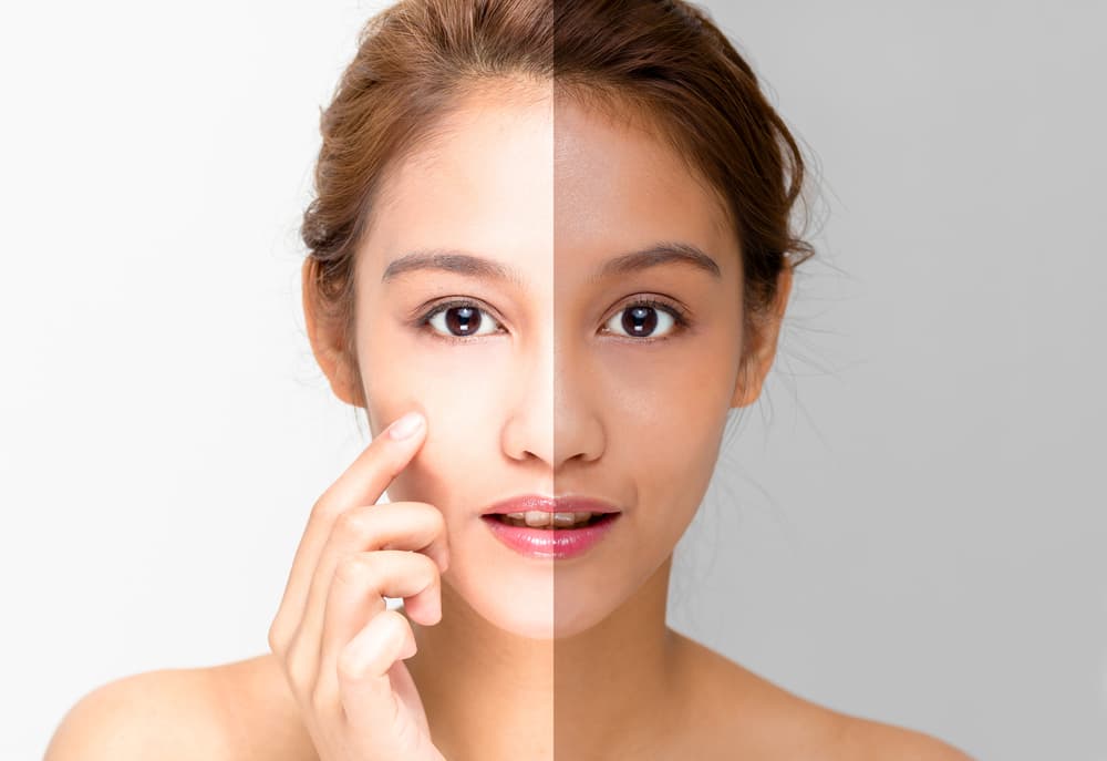 Guide to Popular Skin Brightening Treatments in Dubai