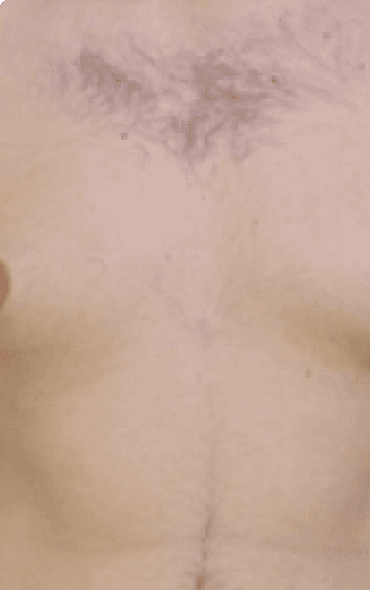 Skin111