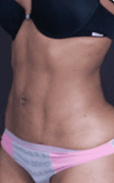Skin111