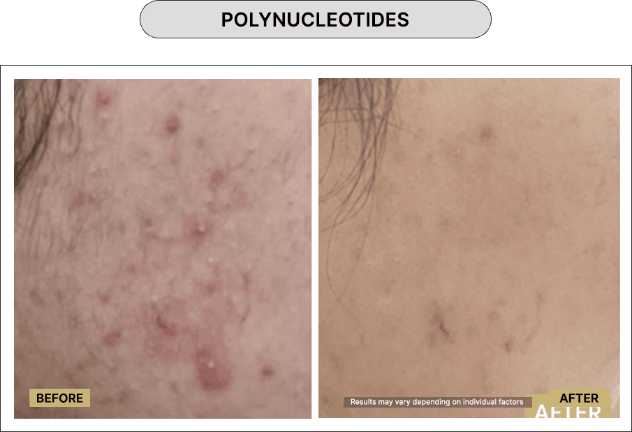 Polynucleotides