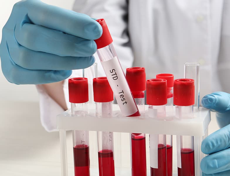 STD Testing