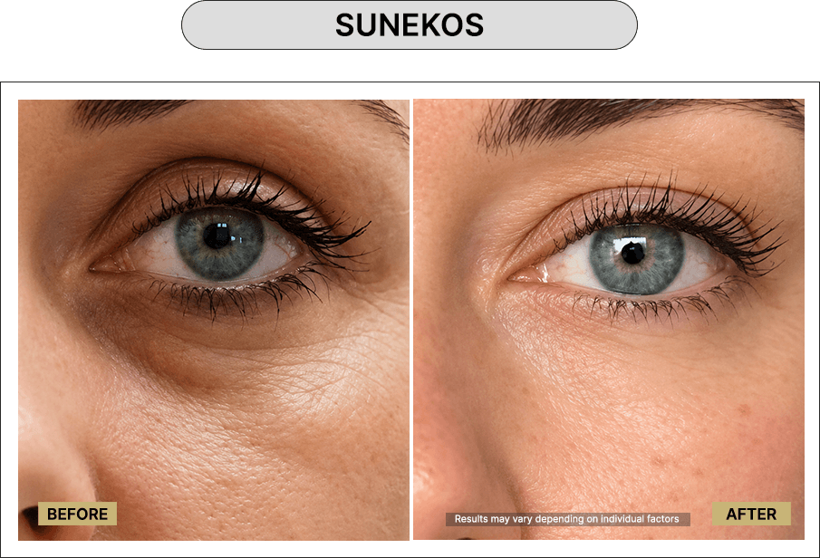 Skin111