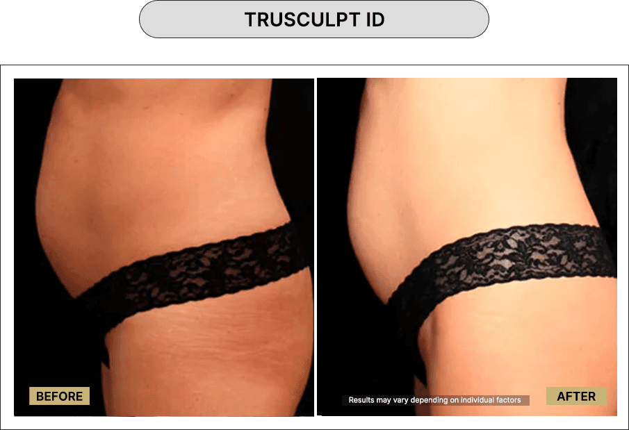 Trusculpt ID