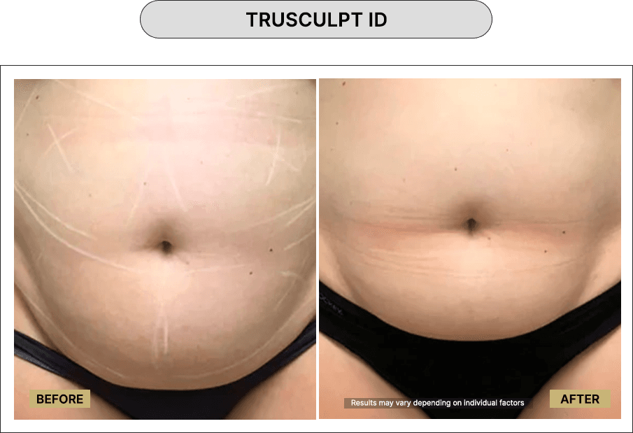 Trusculpt ID