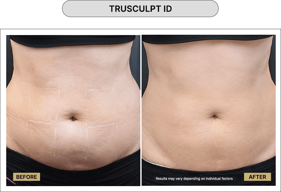 Trusculpt ID