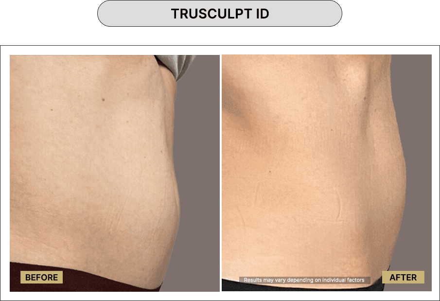 Trusculpt ID