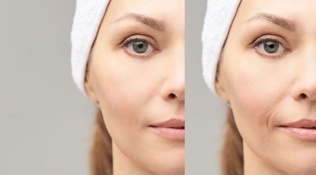 Does IV GLUTATHIONE therapy work