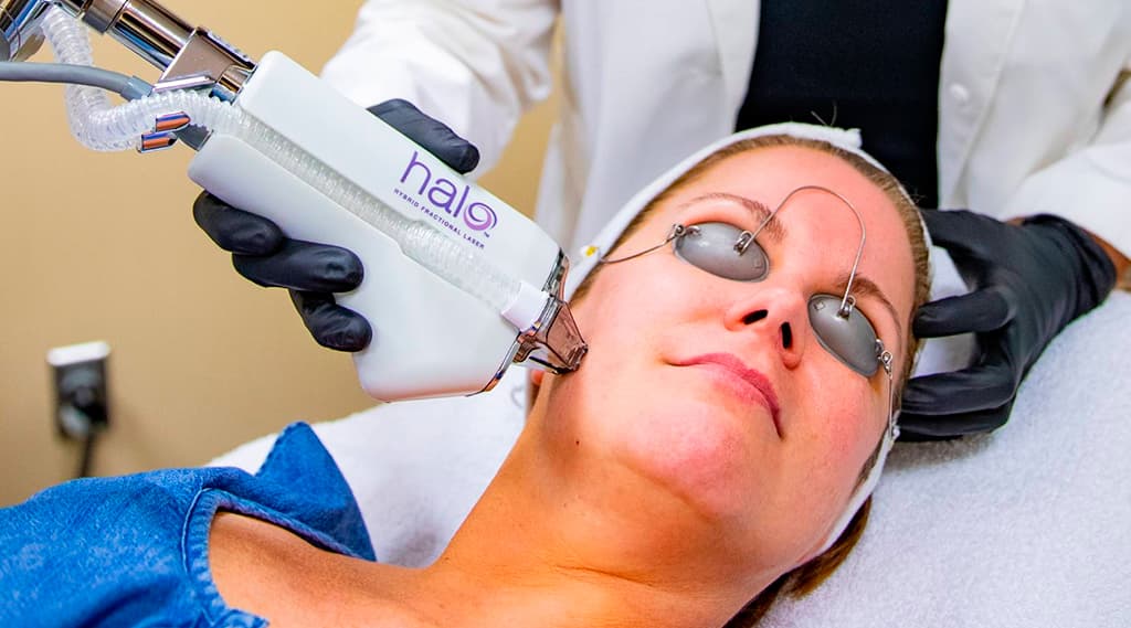 Reversing the Aging Process with HALO: The Revolutionary Skin Treatment That Takes Years Off Your Appearance!