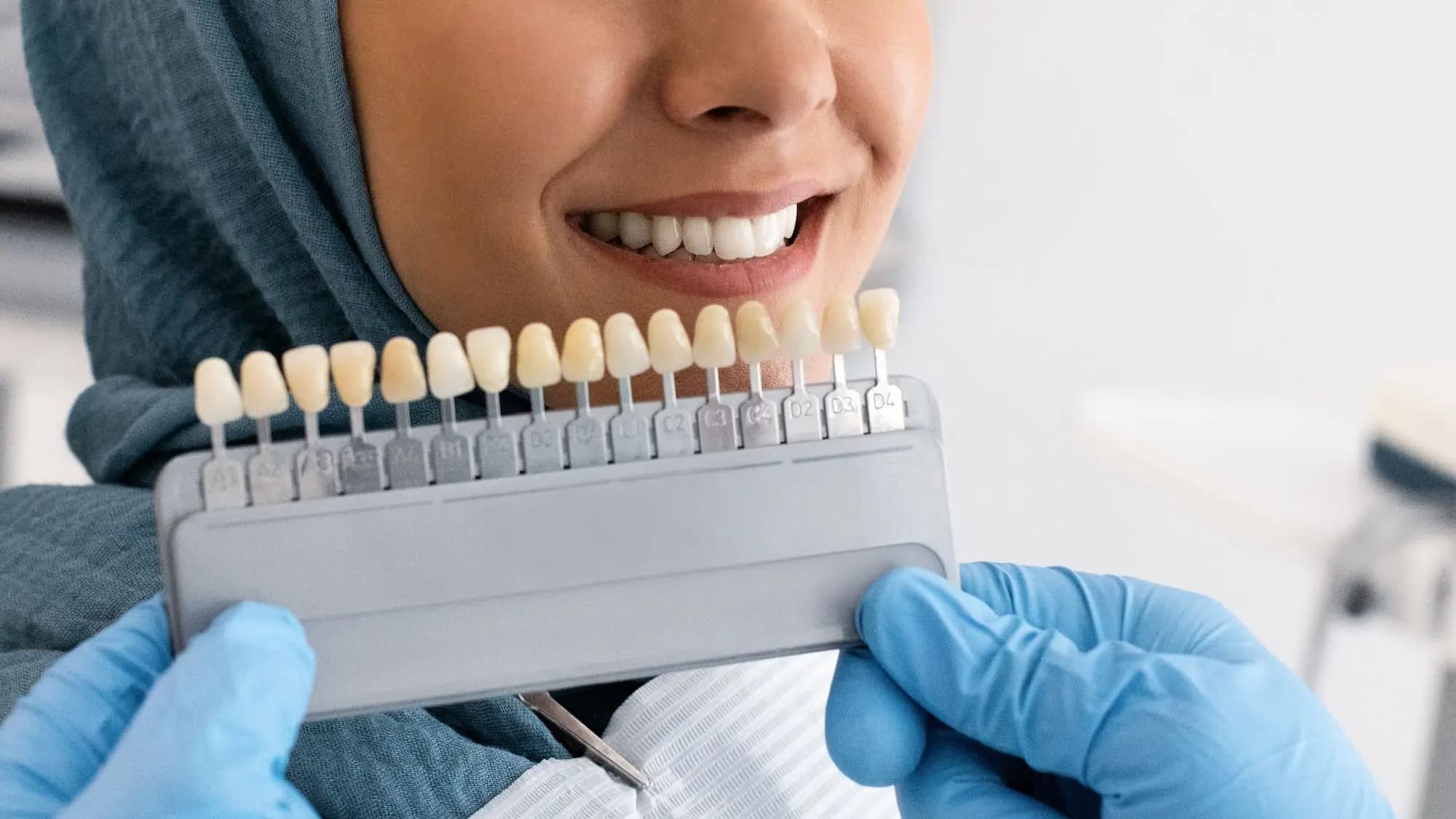 What Are Dental Veneers? Cost, Procedure & Advantages