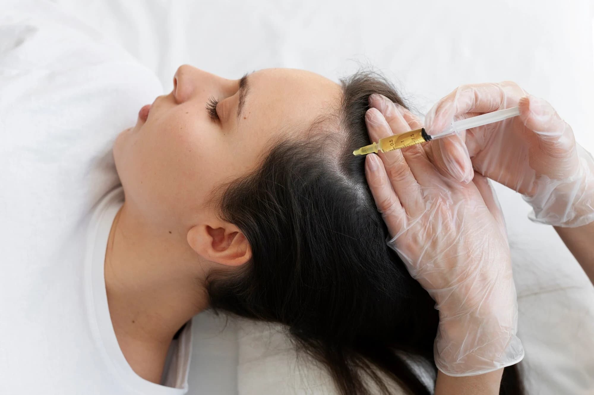 Stem Cell Hair Therapy: Revolutionary Treatment for Hair Loss and Regrowth