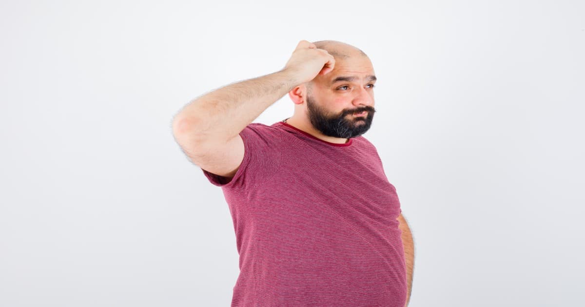 Alopecia Solutions: How Our Technicians Can Help with Hair Loss