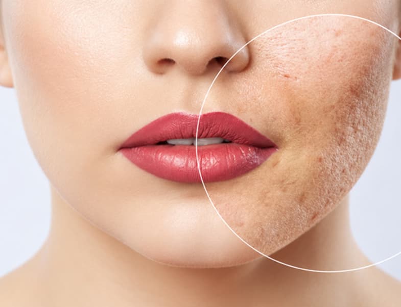 Skin111