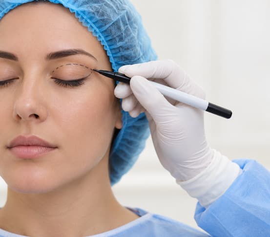 Blepharoplasty