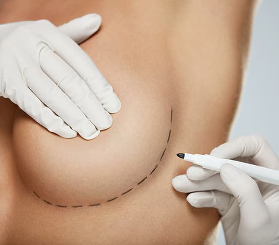 Breast Augmentation