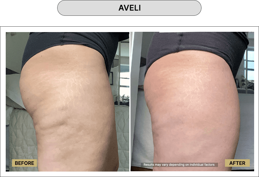 Aveli