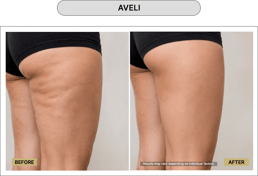Aveli