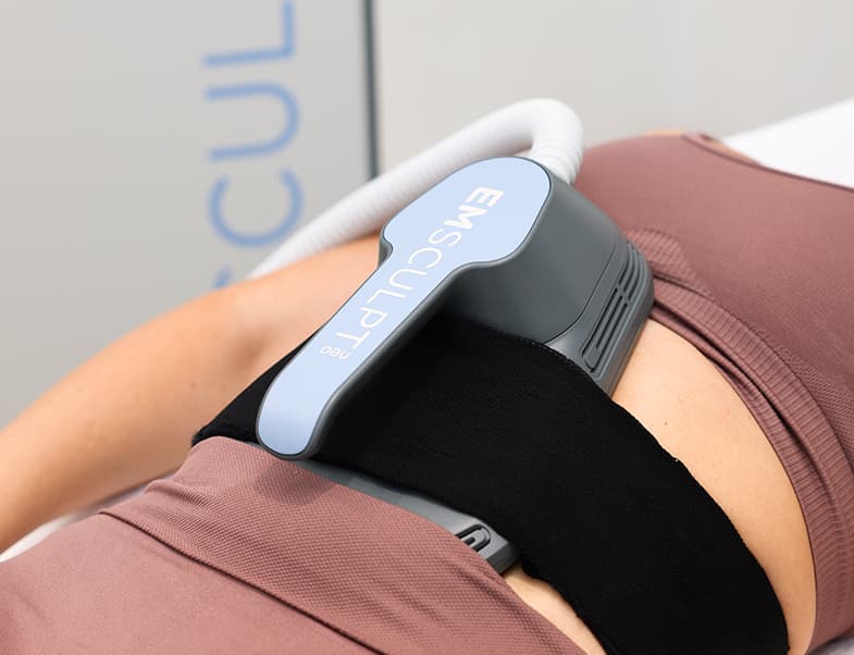 Laser hair removal