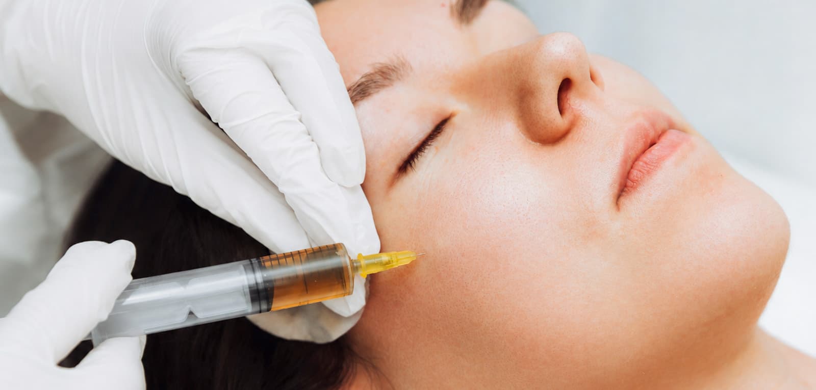 PRP with Subcision in Dubai & Abu DhabiPRP with Subcision in Dubai & Abu Dhabi
