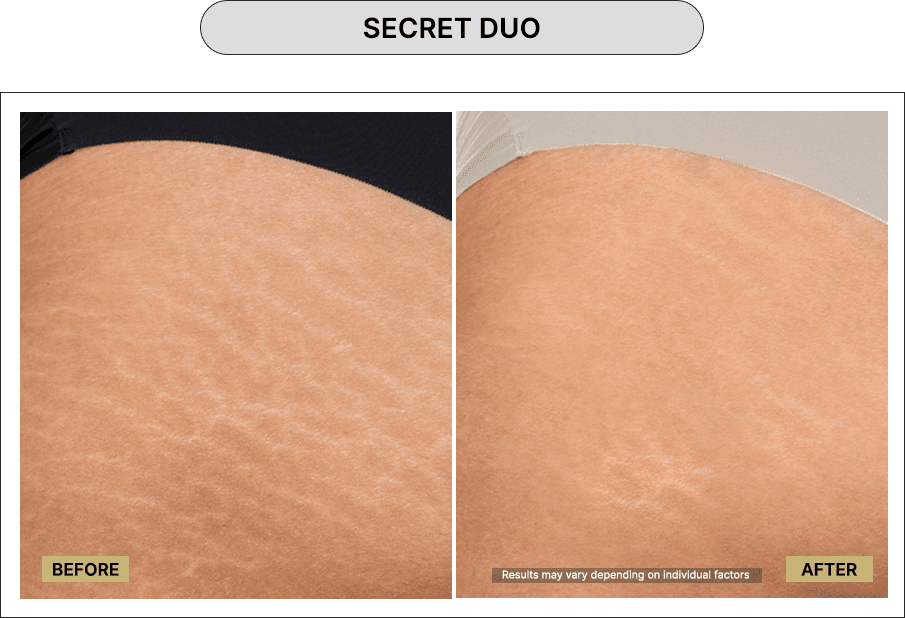 Secret Duo