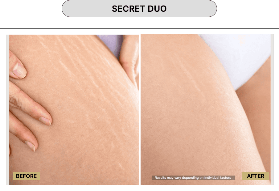 Secret Duo