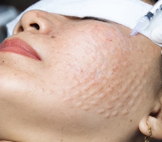 Skin111