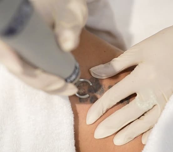 Treatment area