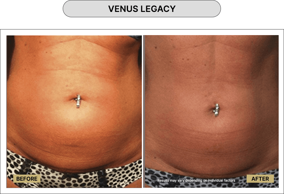 Venus Legacy