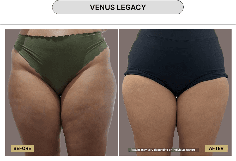 Venus Legacy