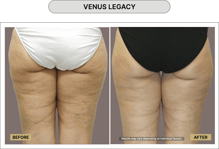Venus Legacy