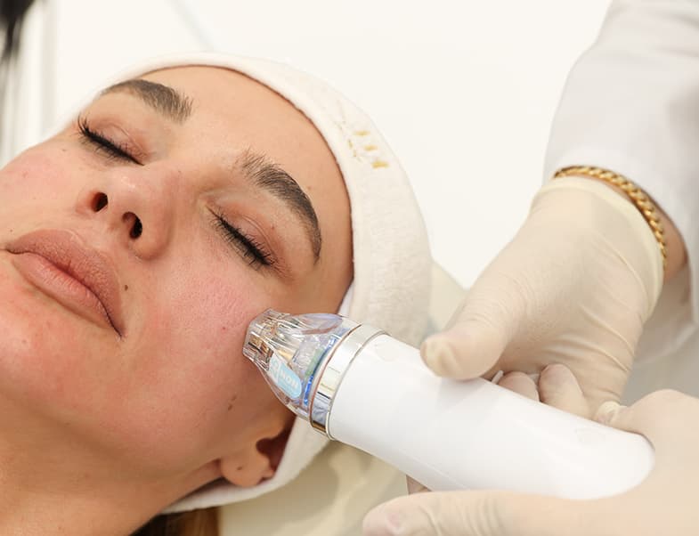 Laser hair removal