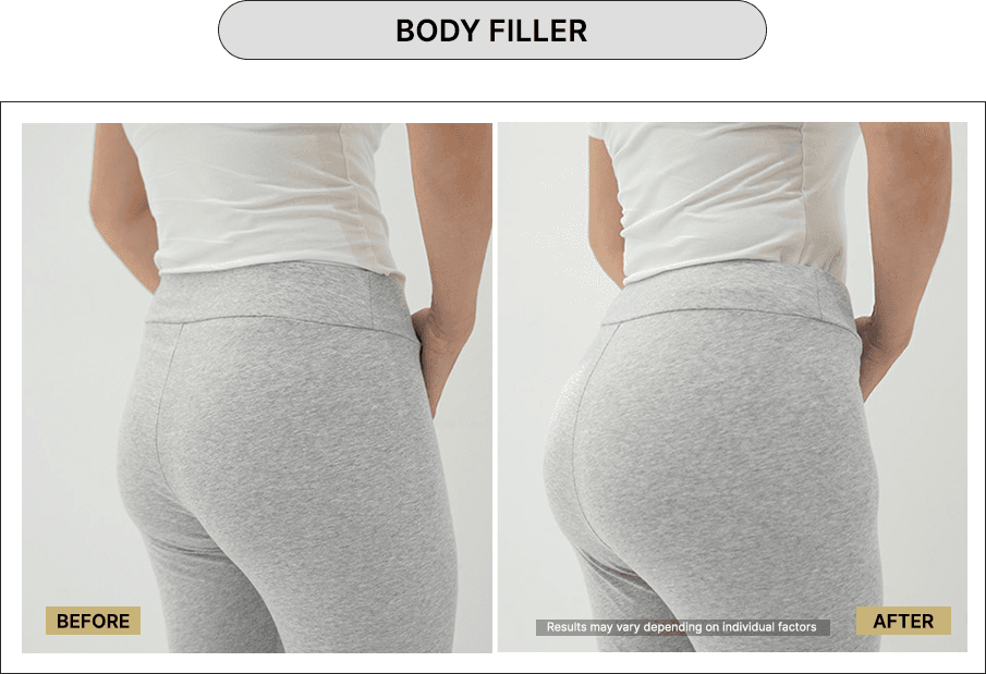 Body Filler