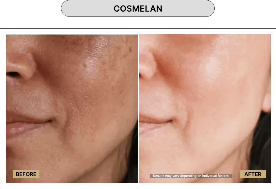 Cosmelan