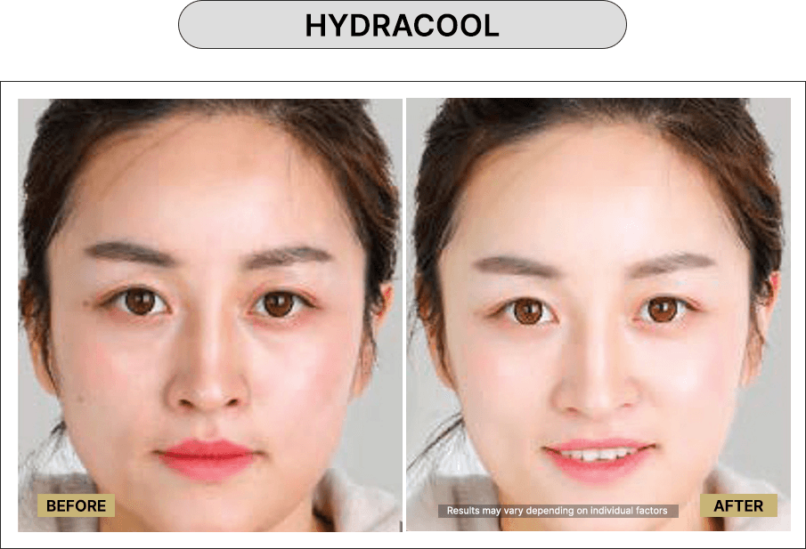 Hydracool