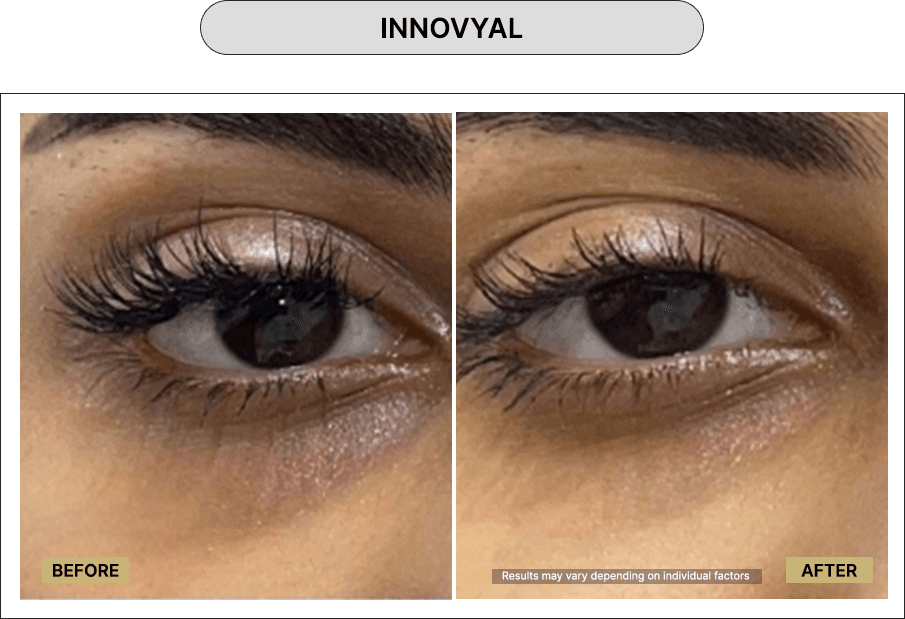 Innovyal
