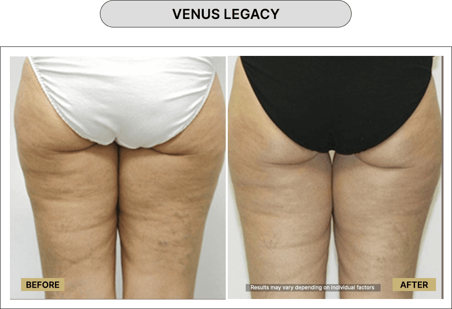 Venus Legacy