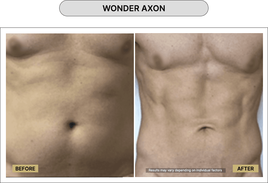 Wonder Axon